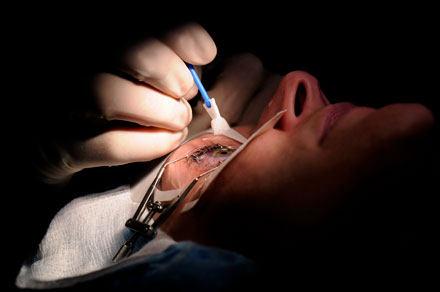 Kvinna som utf�r LASIK-kirurgi.