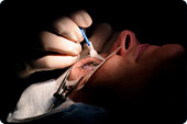 Metoder f�r �gonlaser